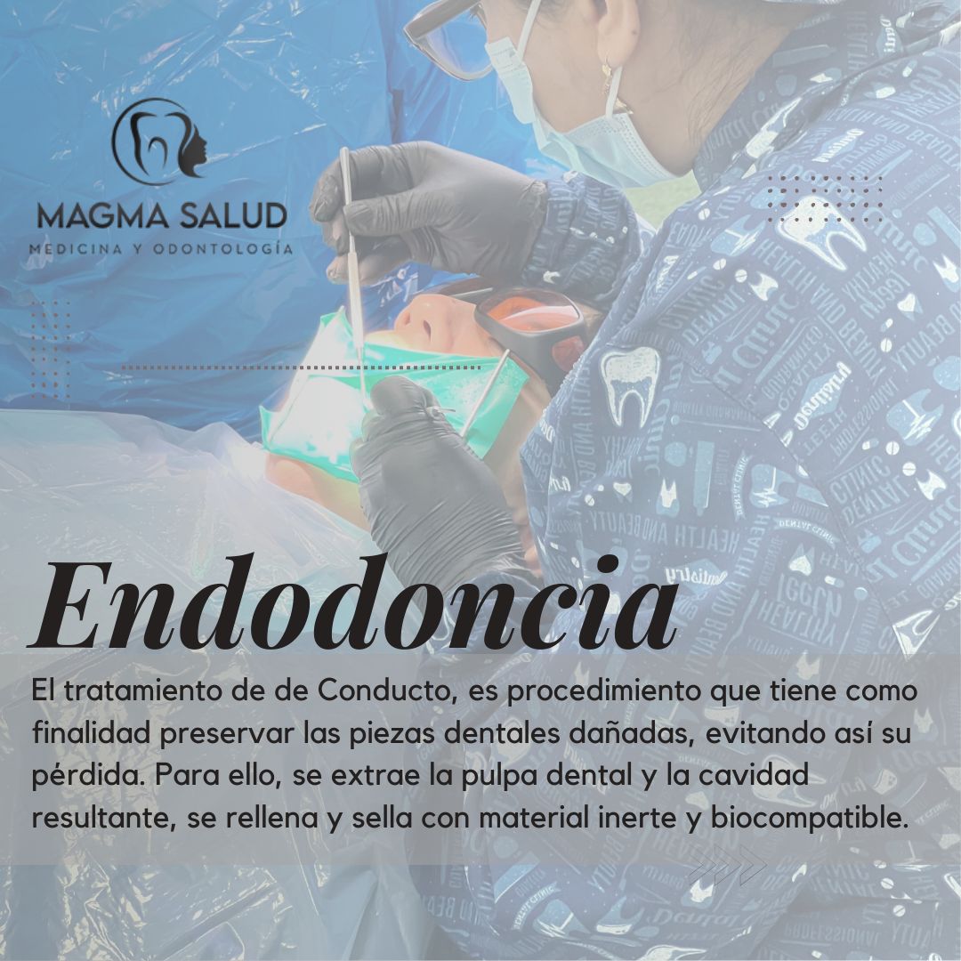 Endodoncia