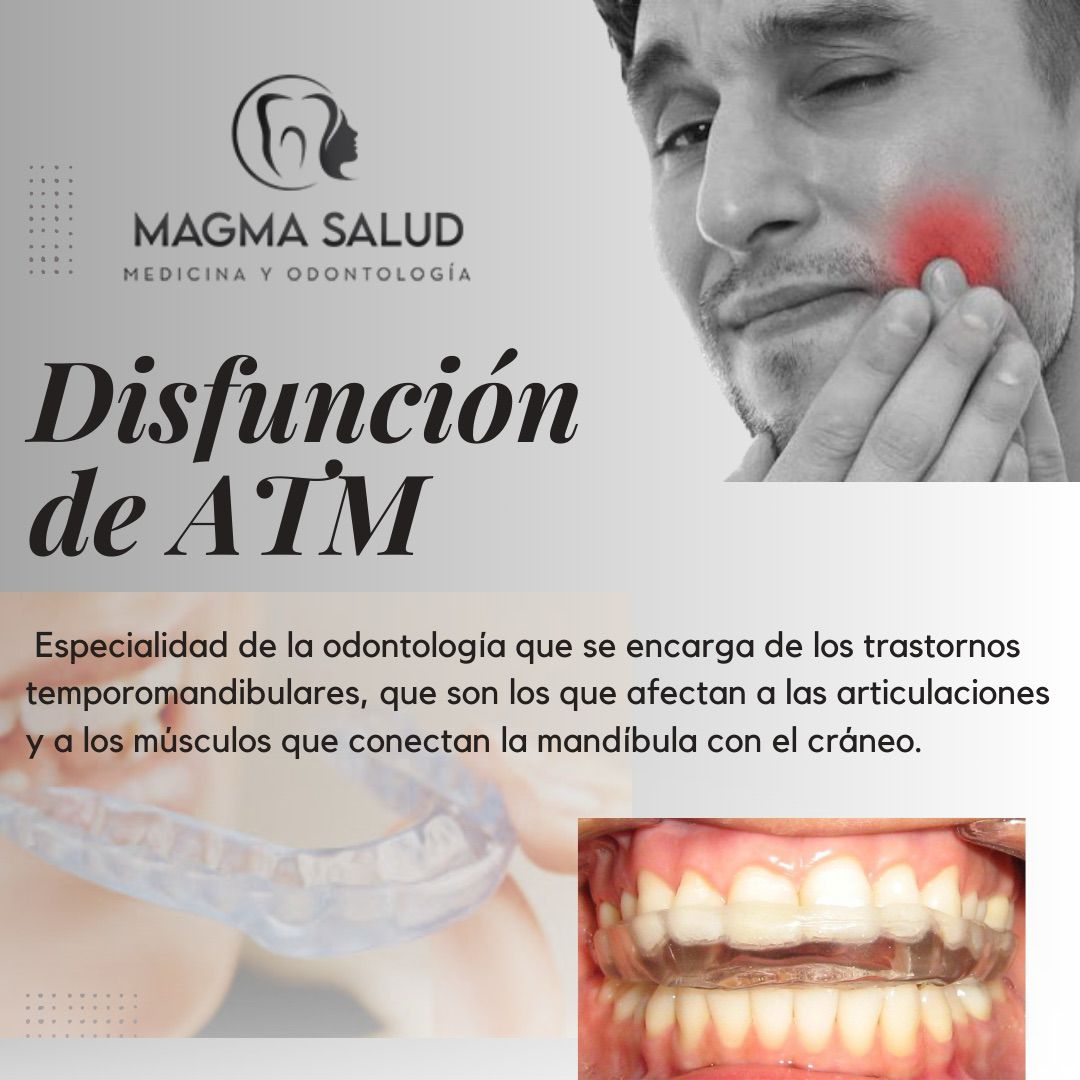 Disfuncion de ATM